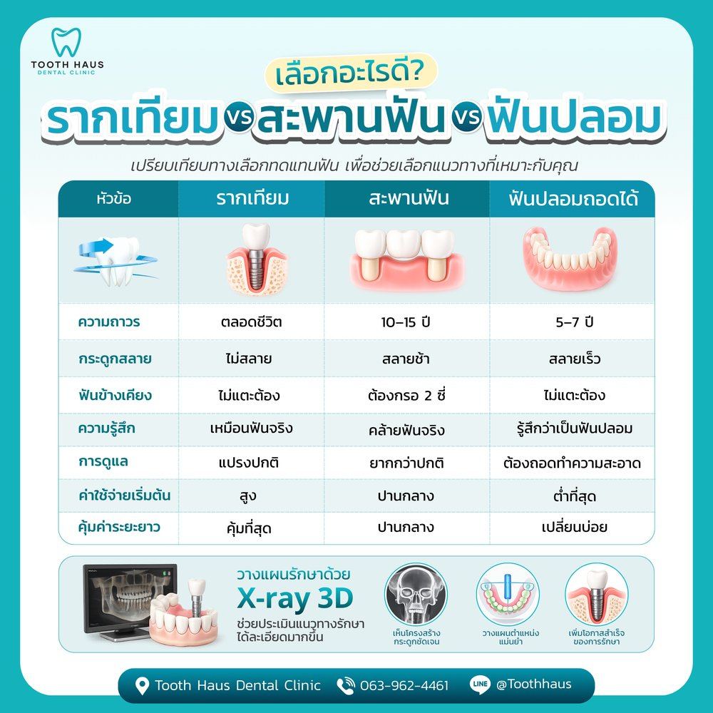 รากเทียม vs ฟันปลอม ต่างกันยังไง?