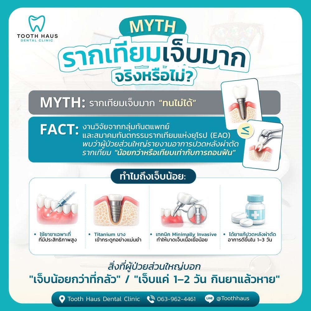 รากฟันเทียมเจ็บไหม
