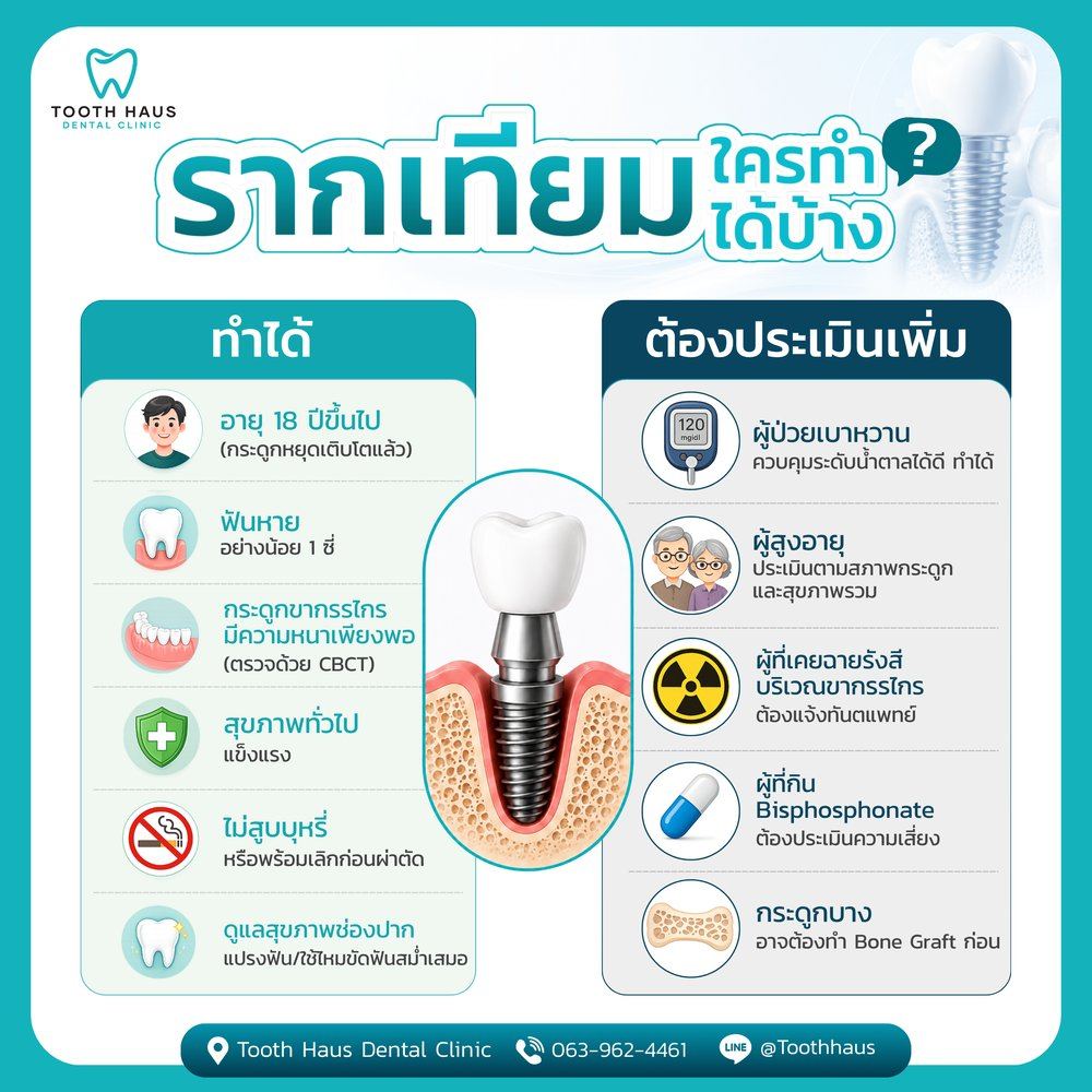 รากฟันเทียมใครทำได้บ้าง เงื่อนไขการประเมิน — Tooth Haus Dental Clinic