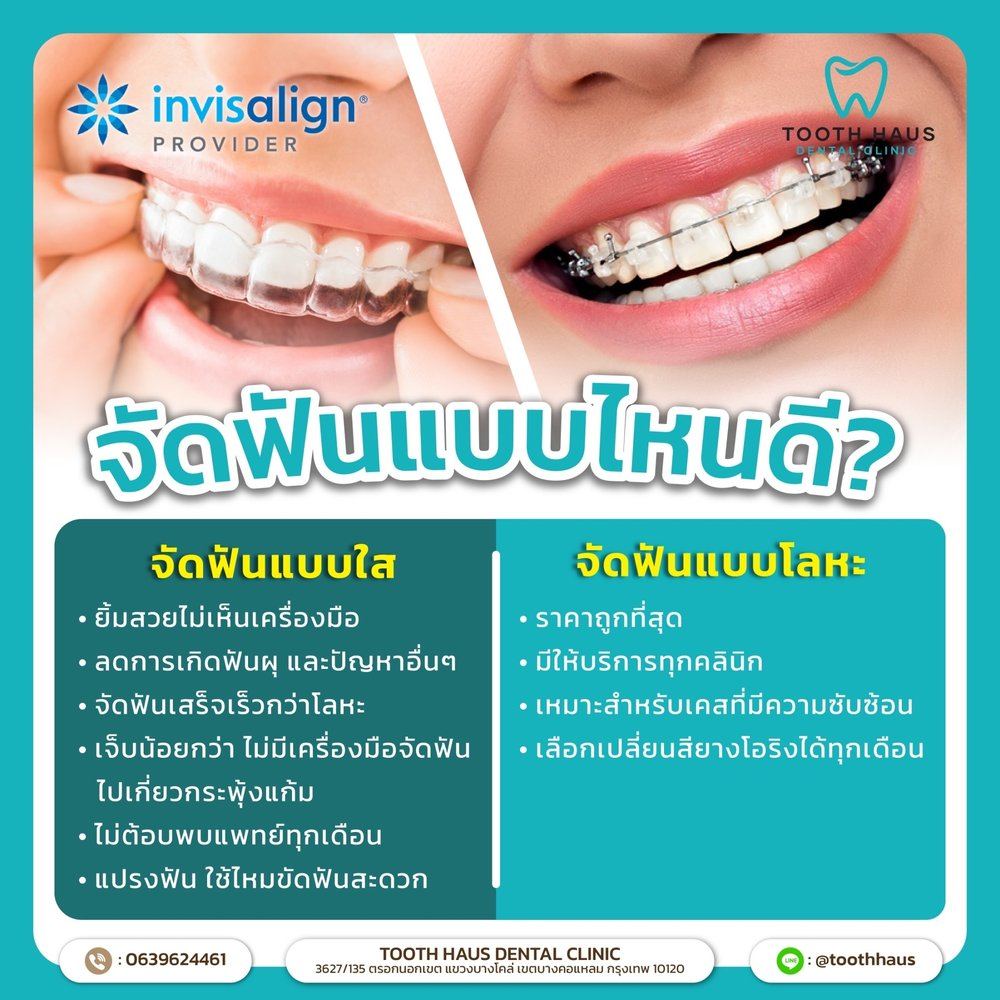 Invisalign clear aligners vs metal braces comparison — Tooth Haus Dental Clinic