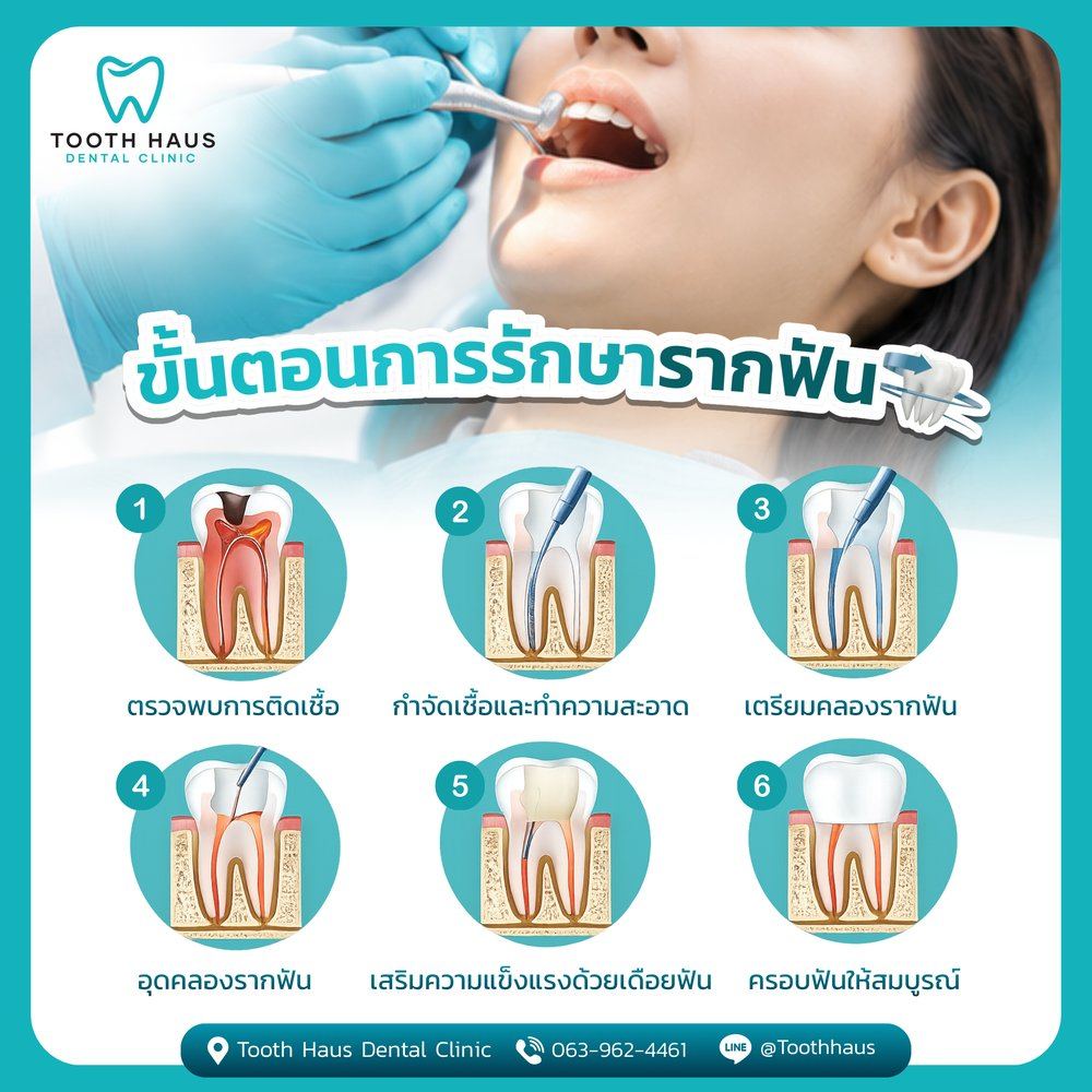 ปวดฟันแบบไหนควรรีบพบทันตแพทย์