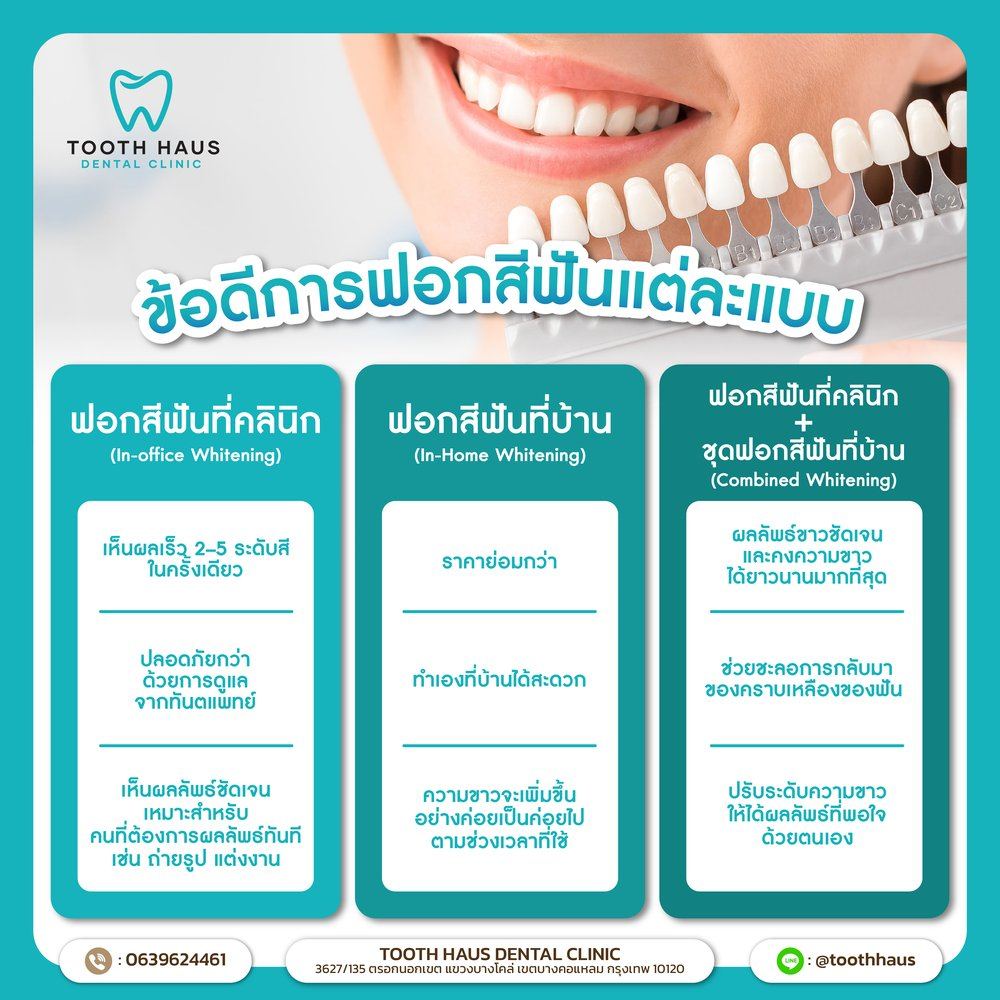 ฟอกสีฟันแบบไหนดี?
